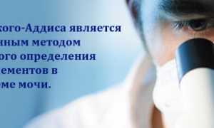Как собрать мочу для проведения пробы по Аддис-Каковскому