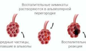 Кашель курильщика: развитие, признаки, как избавиться и лечить, последствия