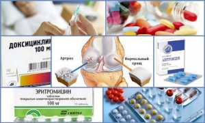Антибиотики при артрите и артрозе суставов: описание препаратов и применение