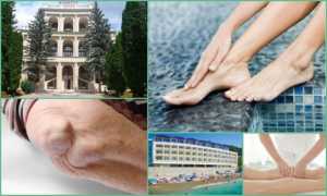 Санаторно курортное лечение при ревматоидном артрите