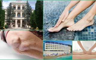 Санаторно курортное лечение при ревматоидном артрите