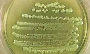 Pseudomonas: свойства, характеристика, патогенность, симптоматика, диагностика, как лечить