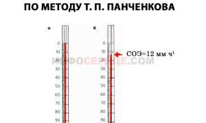 Как измеряется СОЭ по Панченкову?