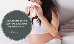 Как лечить насморк при беременности: безопасные методы терапии