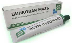 Цинковая мазь от псориаза