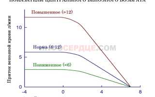Что нужно знать о центральном венозном давлении (ЦВД)?