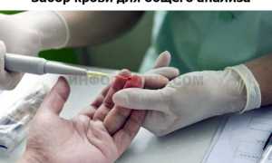 Незрелые гранулоциты в анализе крови