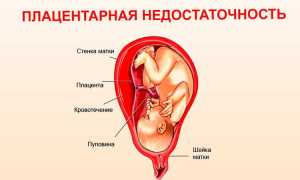 Что означает нарушения в системе мать плацента плод