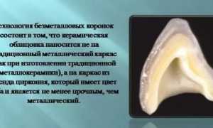 Циркониевые коронки: плюсы и минусы, отличия, показания для установки