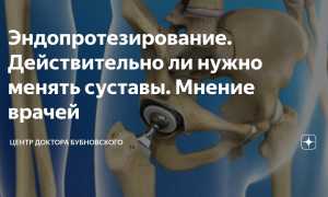 Причины и лечение болей после эндопротезирования коленного и тазобедренного суставов