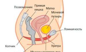 Непроизвольное мочеиспускание у женщин – причины, симптомы, лечение