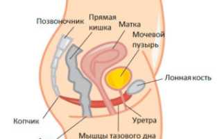Непроизвольное мочеиспускание у женщин – причины, симптомы, лечение