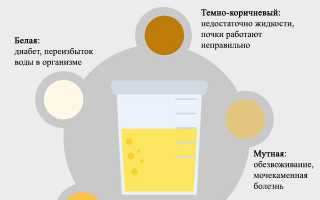 Причины помутнения мочи у беременных женщин