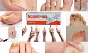 Мазь Микосептин от грибка