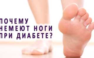 Почему немеют ноги при сахарном диабете — что делать, как лечить онемение?