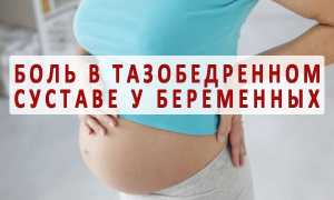 Почему при беременности болят тазобедренные суставы — как лечить?