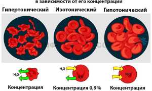 Что такое гипертонический раствор и как он действует?