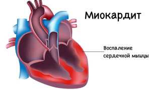 Не хватает воздуха при дыхании