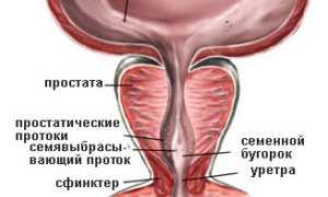 Признаки и лечение колликулита у мужчин