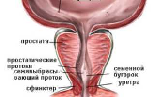 Признаки и лечение колликулита у мужчин