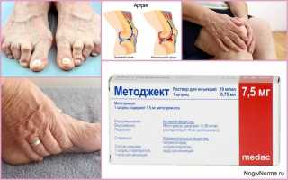 Полная инструкция по применению препарата Методжект при ревматоидном артрите