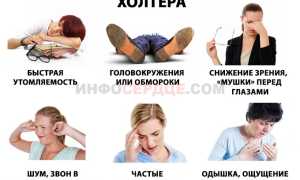 Что такое холтер мониторинг сердца?