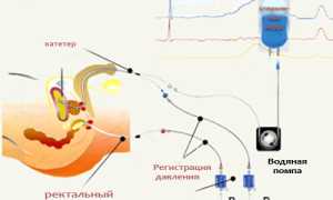 Что такое цистометрия: как проводится, критерии оценивания