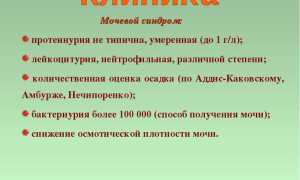 Мочевой синдром как признак почечных заболеваний