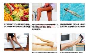 Что такое ретикулярный варикоз?