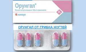 Орунгал от грибка ногтей — отзывы, цена, аналоги