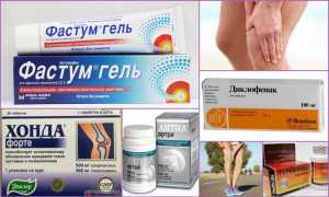 Обзор лучших лекарств от артроза коленного сустава