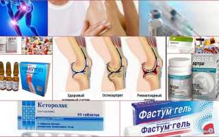 Эффективные препараты от боли в суставах