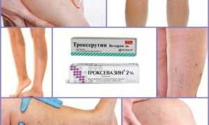 Троксевазин и Троксерутин — в чем разница?