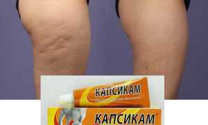 Применение мази Капсикам от целлюлита