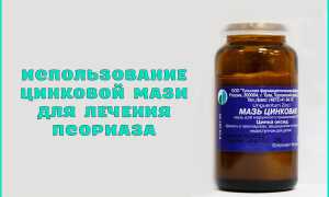 Цинковая мазь при псориазе — отзывы, цена, аналоги