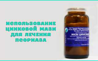 Цинковая мазь при псориазе — отзывы, цена, аналоги