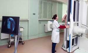 Что такое флюорография и зачем ее делают — описание диагностики и ее особенности во всех подробностях