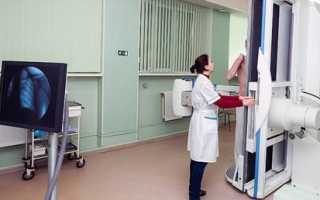Что такое флюорография и зачем ее делают — описание диагностики и ее особенности во всех подробностях
