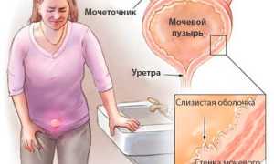 Применение экстракта клюквы в таблетках при урологических патологиях