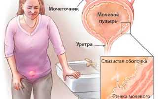 Применение экстракта клюквы в таблетках при урологических патологиях