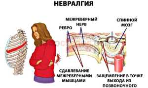 Что может вызывать перебои в работе сердца?