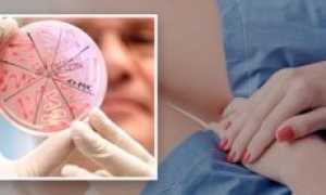 Бывают ли выделения при цистите у женщин и мужчин?