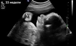 Во сколько недель делают третье УЗИ во время беременности и зачем, что оно показывает