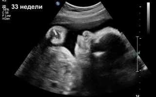 Во сколько недель делают третье УЗИ во время беременности и зачем, что оно показывает