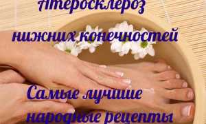 Лечение атеросклероза сосудов нижних конечностей народными средствами