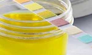 Изменение цвета мочи у взрослых и детей на ярко-желтый оттенок