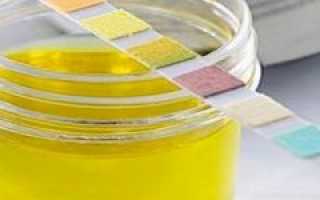 Изменение цвета мочи у взрослых и детей на ярко-желтый оттенок
