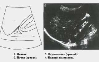 Что показывает УЗИ надпочечников, как его делают и что значит если орган не видно