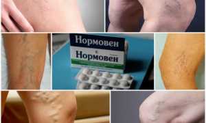 Нормовен для здоровья сосудов