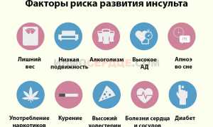 Все что нужно знать про обширный инсульт